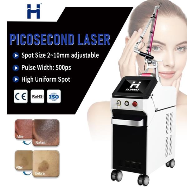 Dark Circles and Tattoos 1064nm/532nm Wavelength Picosecond Laser