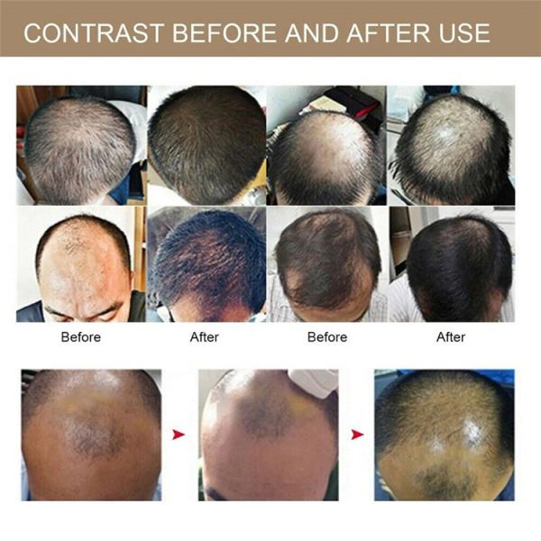 650nm llevó la terapia del laser del casco del crecimiento del pelo de los lasers del diodo 26 de la luz 30 para la pérdida de pelo