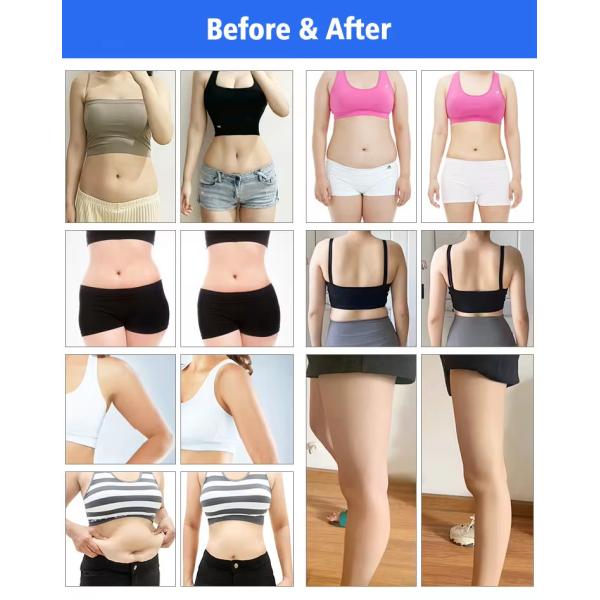 Body Slimming Laser Lipolysis Machine 450W Lumewave Master Fat Removal Machine