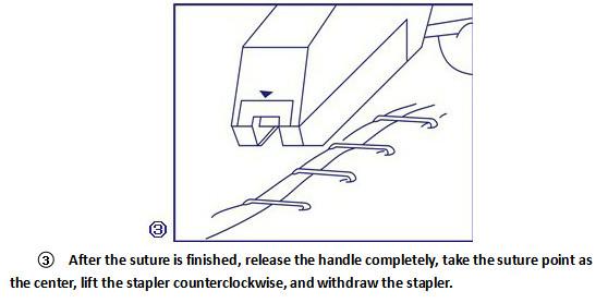 Medical Surgical Trupler Skin Stapler Machine With Scale And Remover