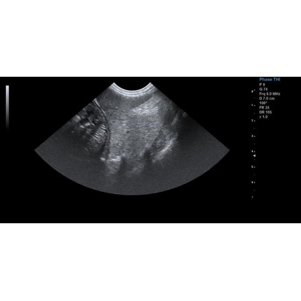 21.5'' LCD Trolley Veterinary Ultrasound Scanner M Mode Imaging