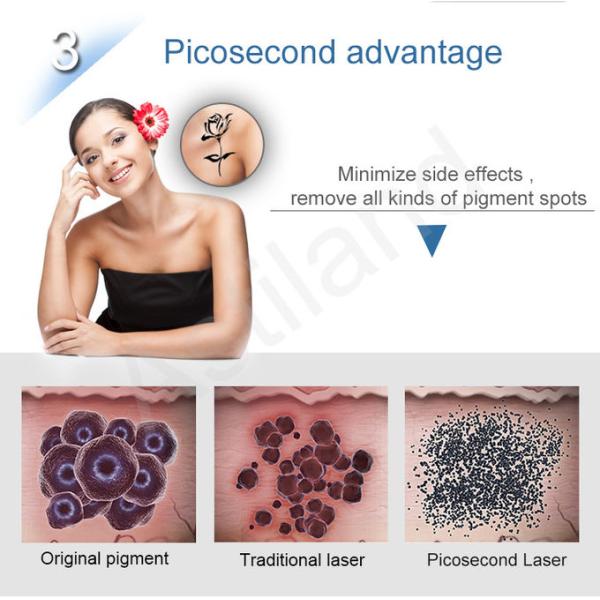 Astiland лицевое 5ns q переключило машину лазера ND Yag