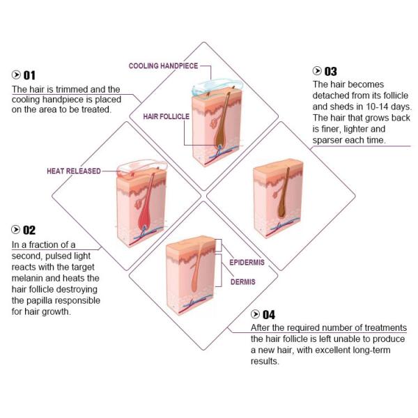 Pain Free IPL SHR Hair Removal Machine , Non - Invasive Beauty Light Laser