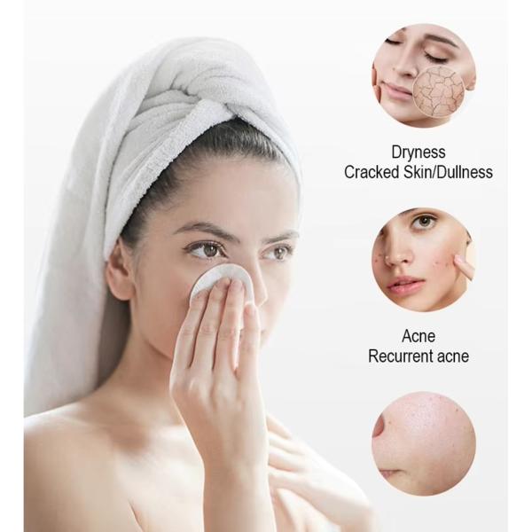 New Arrival Black Pearl 10 In 1 Hydra Peel Machine Microdermabrasion Machine Facial Spa Micro-Touch Hydra Skin Care