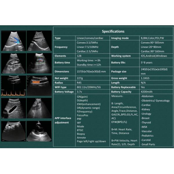 128 Elements Medical Hospital Equipments Color Doppler Portable Wireless Ultrasound Machine 3 In 1