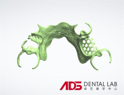 ADS Dental Lab Partial Metal Frame Denture Framework Fabrication