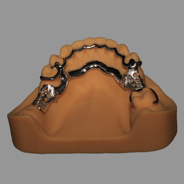 Vitallium 2000 Cast Metal Framework Dental Bar Design Corrosion Resistant