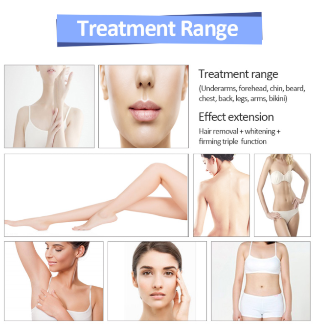 Portable 3 Waves 755 808 1064nm Diode Laser Hair Removal Machine For Home Beauty Salon Use