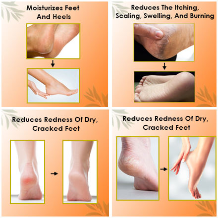 Salicylic Acid Hand Foot Heel Repair Balm Body Care Moisturizing Nourishing