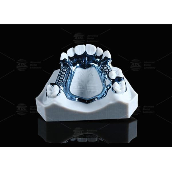 Cadre en titane imprimé 3D anodisé léger et adapté à la peau sensible