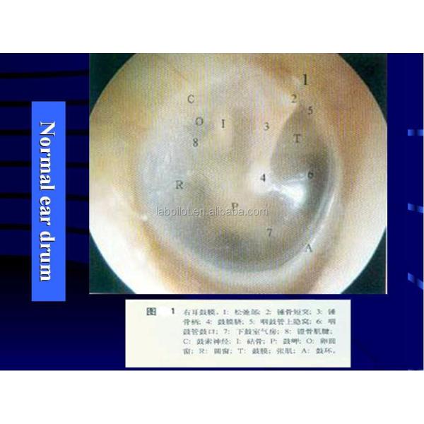 Medical Education Ear Examination Model Realistic Human Simulation with 14-pc Set