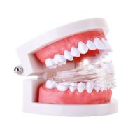 Aparelho Ortodôntico Invisível Materiais Dentários Estética Conveniente