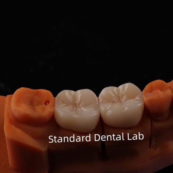 Полный контур циркониевая корона прозрачность 3D PRO без фарфорового покрытия Стандартная стоматологическая лаборатория