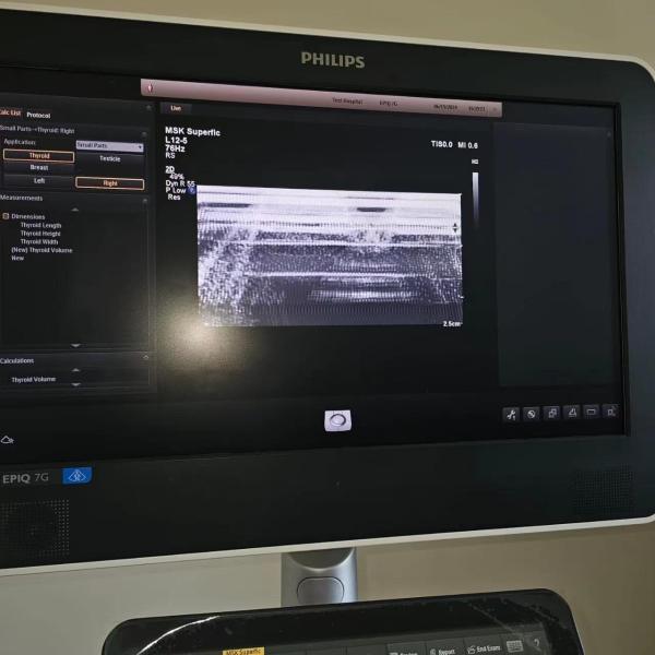 Repair ATL Affiniti50 Affiniti70 Original Acquisition Module ACQ 4535161610416
