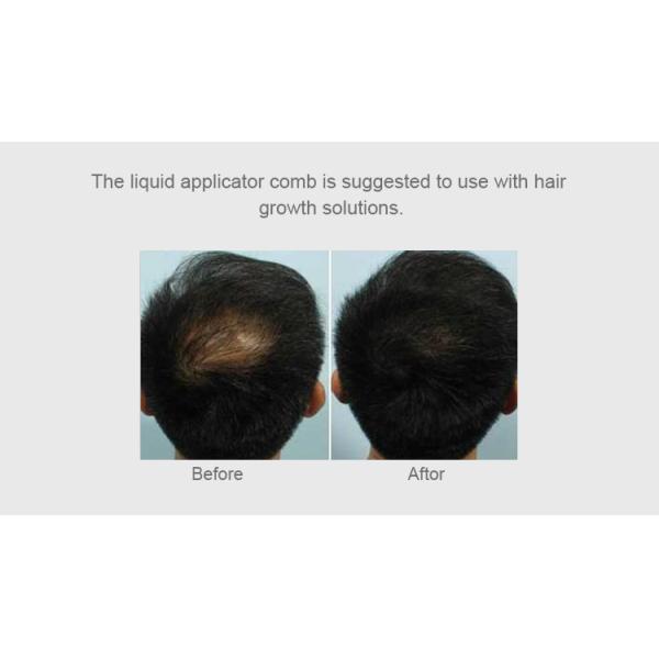 Hair Growth Root Applicator with 625nm Red Light Wave and Microcurrent Technology