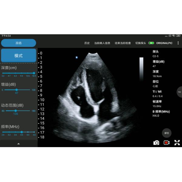 5MHz Pocket Handheld Ultrasound Scanner For Mobile Cardiac Diagnosis