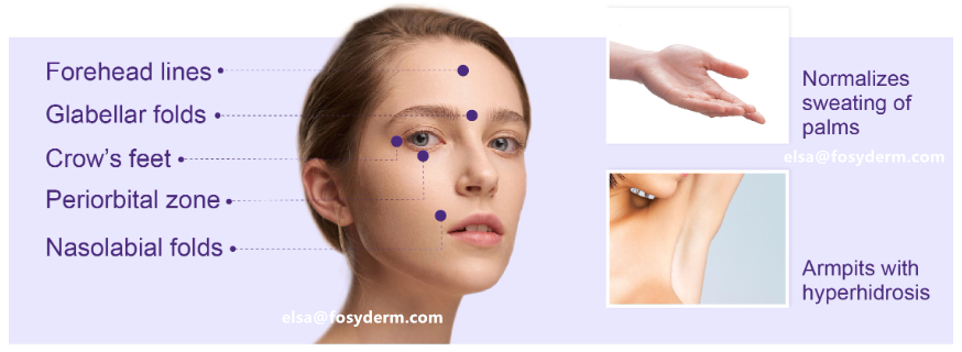 Hot Botox Injection Dysport for Removing Wrinkles Botulinum toxine
