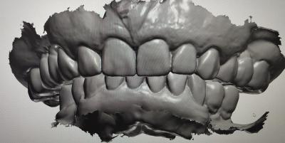 CAD CAM Design Digital Display Mockup Teeth Other Dental Products