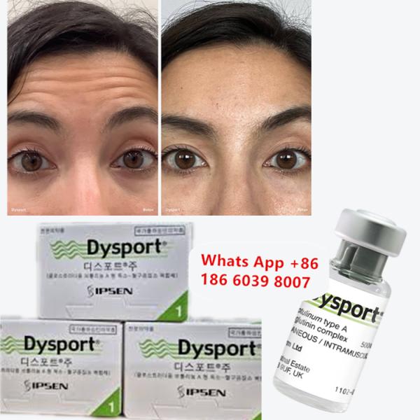 Botulinum Toxin Dysport Anti-wrinkle Freeze-Dried Powder For Slimming the face