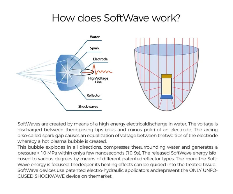 10-барная фокусированная Gainswave Ed ESWT Машина для терапии ударными волнами низкой интенсивности/уменьшение боли