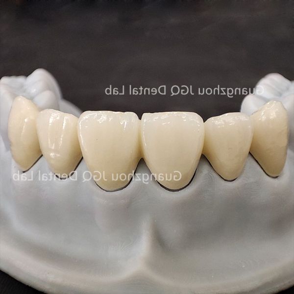 Zirconia Crown Bridge Dental Laboratory China High Accuracy CE FDA ISO Standard