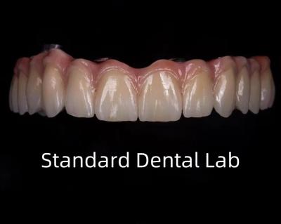 Titânio Full Zirconia Bridge Translucidez Dental Na Barra Implante