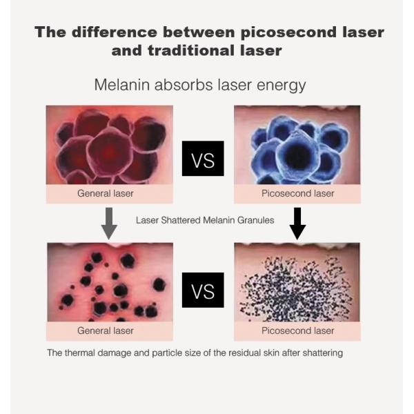 Advanced Fractional Laser Beauty Machine Utilizing Picosecond Laser Q Switching ND YAG Technology for Effective Removal of All Tattoo Colors and Skin Rejuvenation