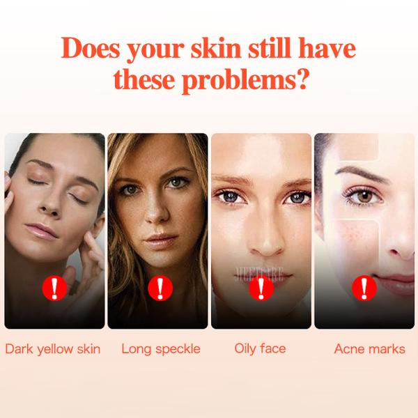 7 цветов LED маска для лица Для лечения прыщей Омолаживание кожи Удаление морщин