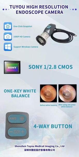TUYOU Manufacturer USB Portable Endoscope Camera For ENT Endoscopy Pet Checking Video Endoscopy On Laptop