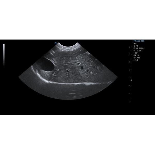 21.5'' LCD Trolley Veterinary Ultrasound Scanner M Mode Imaging