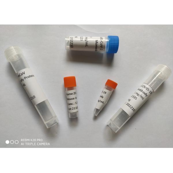 Антитело рекомбинатного шипа моноклонального антитела мыши (2019-NCoV) нейтрализуя, антитело Mab мыши изготовленное на заказ моноклональное