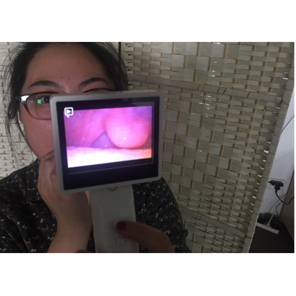 3,5 медленно двигают медицинская камера офтальмоскопа Отоскопе цифров видео- с устранимым Эармуфф