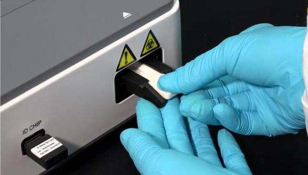 CA125 Test Kit High Sensitivity High Accuracy in whole blood, plasma and serum
