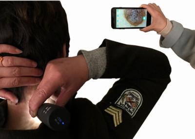 WIFI Skin Analyer Digital Video Dermatoscope Skin Watcher With 2 Million Pixels