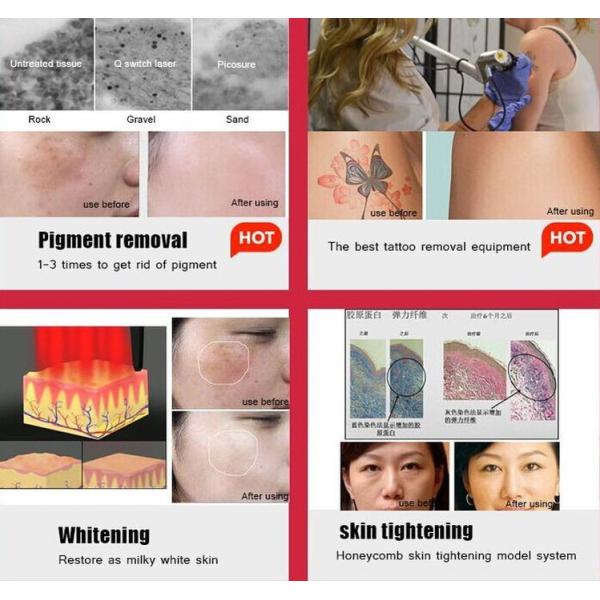 Красное зеленое оборудование удаления татуировки машины 500ps лазера пикосекунды