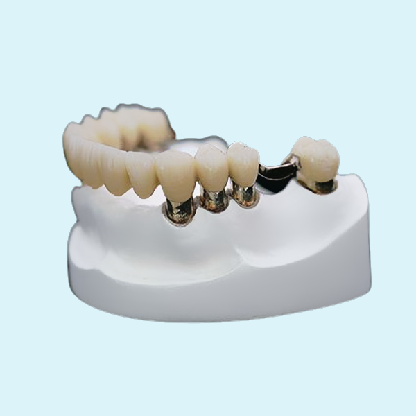 Denture приложения точности кроны коррозионной устойчивости стабильность зубоврачебного телескопичного сильная