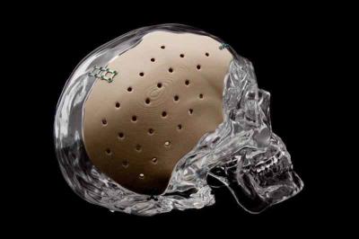 Standard Medical Injection Molding Parts With Ergonomic Design