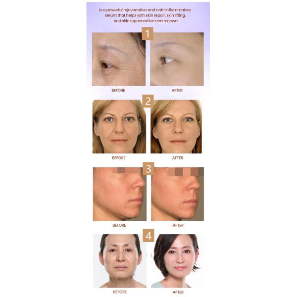 Противовозрастный цитокаре 502 516 715 640 5мл Х 10вл 5вл сыворотка