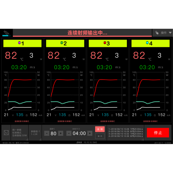 4-Channel RF Lesion Generator with Monopolar Bipolar and Tripolar RF