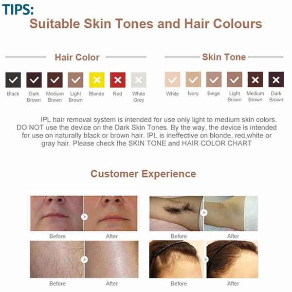 350000 Pulses 24V 1.9A Ipl Laser Hair Removal Device