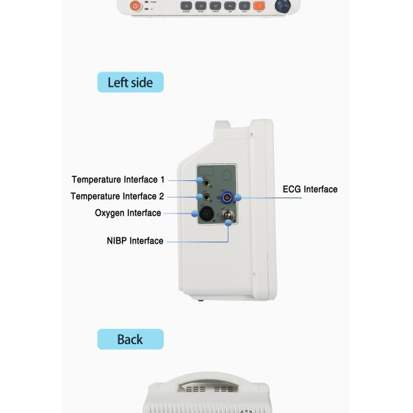 Monitor de paciente multiparamétrico con fuente de alimentación eléctrica, batería incorporada y alarma inteligente de tres niveles