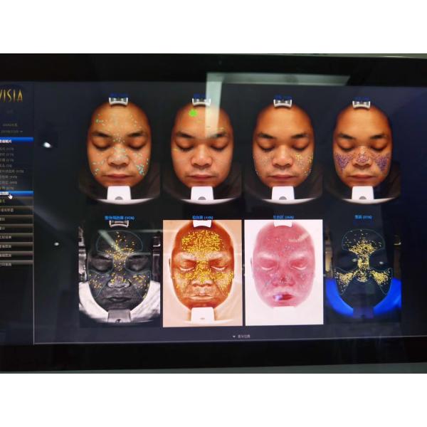 Best Faical Analysis Machine VISIA Skin Analyzer : Automated Spot Detection & Enhanced Texture Recognition
