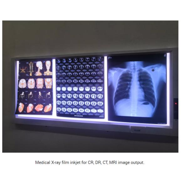 Nontoxic 180 Microns Medical X Ray Film For Ultrasound Report Output