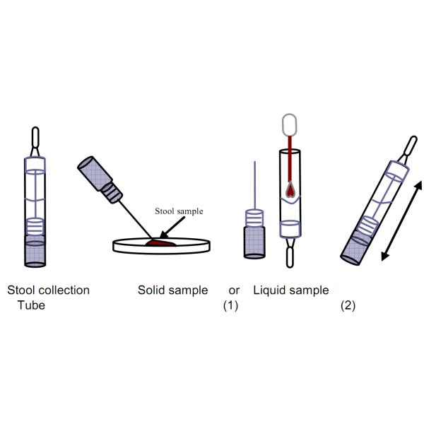 Набора анализа крови аденовируса формат 99% Аккруаси прокладки комбинированного фекального быстрый диагностический