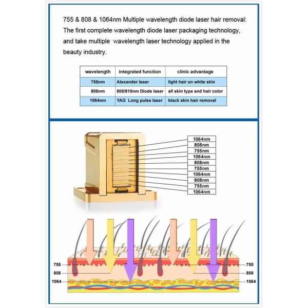 Оборудование красоты лазера диода 755 808 1064 подмолаживаний кожи удаления волос