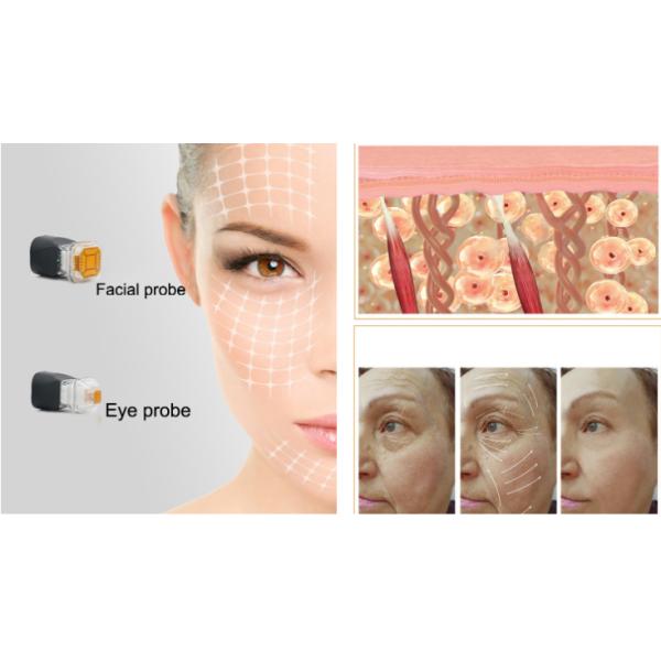 Portable 2 Probe Skin Tightening Thermagic RF Beauty Equipment Wrinkle Removal