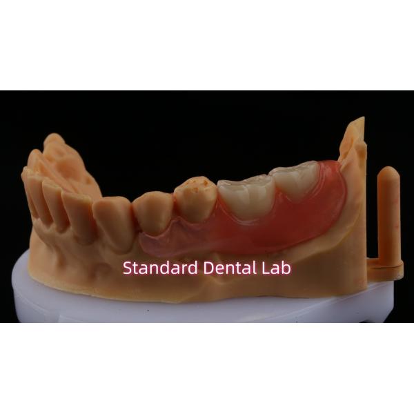 Ace Teeth Розовый/темный TCS Valplast Гибкие частичные зубные протезы для высокой эстетики