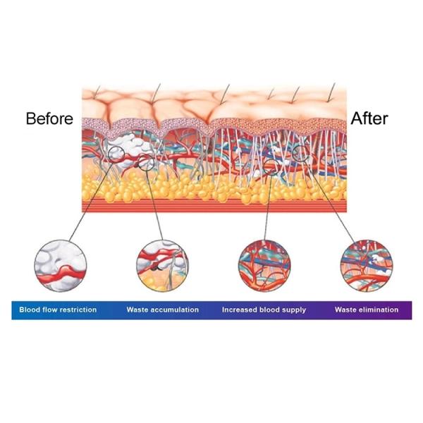 Máquina de la terapia de la onda de choque de Eswt del retiro de las celulitis de la pantalla táctil