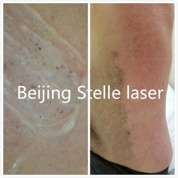 Professional IPL SHR Hair Removal Machine Multi Functional Skin Care Beauty Instrument