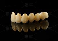 Porcelaine esthétique solide fusionnée avec du zirconium pour des restaurations naturelles